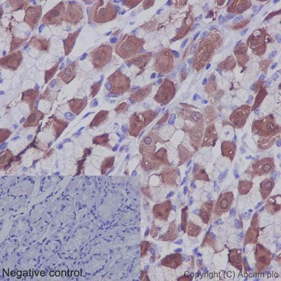 Anti-IKB alpha antibody [E130] - BSA and Azide free(AB215972)