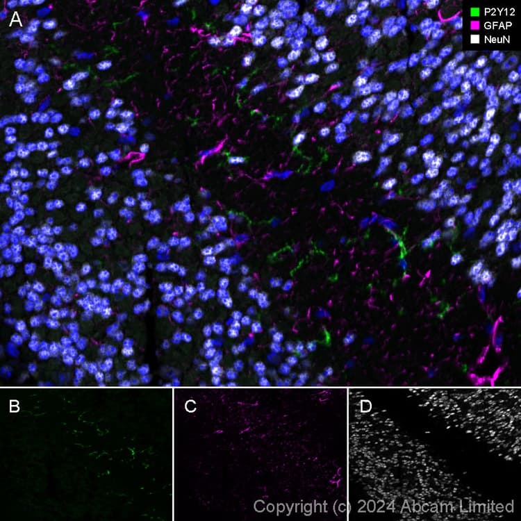 Alexa Fluor® 647 Anti-NeuN antibody [EPR12763] - Neuronal Marker(AB190565)