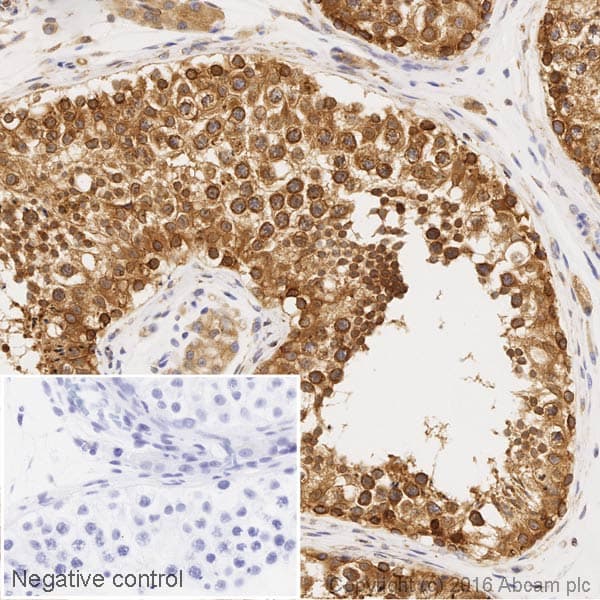 HRP Anti-RanGAP1 antibody [EPR3295]