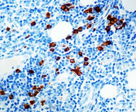 Anti-Myeloperoxidase antibody(ab9535)