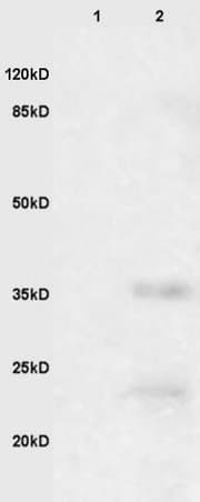 Anti-EpCAM antibody(AB216832)