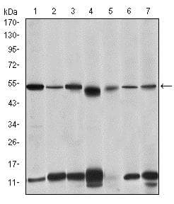 Anti-IRAK4 antibody [2H9](AB119942)