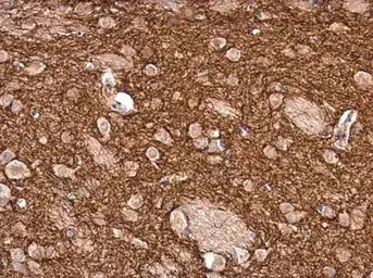 Anti-Tyrosine Hydroxylase antibody(AB137721)