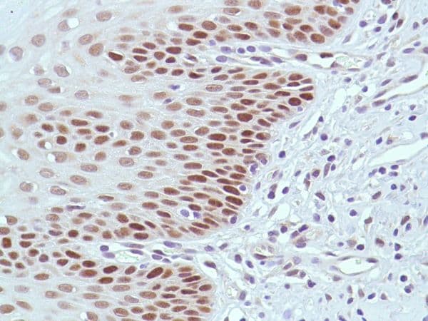 Anti-MSH2 antibody [SP46](AB231437)