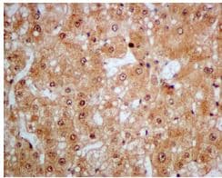 Proteasome Subunit Beta Type 2 Psmb2 Antibody Epr88262b Bsa And Azide Free Ab249366  Immunohistochemistry Formalin Pfa Fixed Paraffin Embedded Sections Img63738