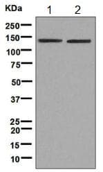 Anti-Tat-SF1 antibody [EPR9104(B)] - BSA and Azide free(AB248932)