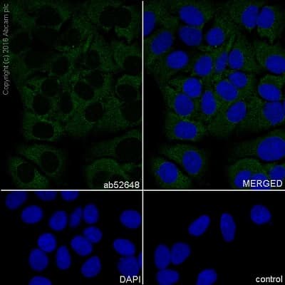 Anti-Flt3 ligand/Flt3L antibody [EP1140Y] - BSA and Azide free(AB232487)