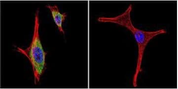 Anti-iNOS antibody(ab3523)