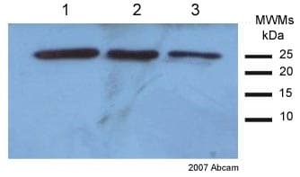 Anti-SOD2/MnSOD antibody(AB13533)