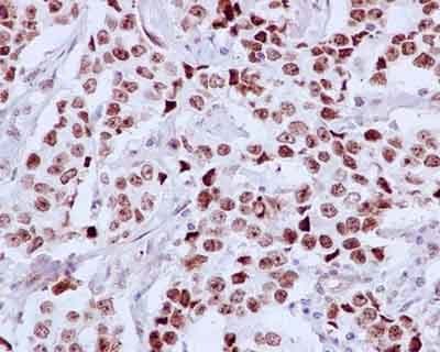 Ddx21 Antibody Epr14495 Ab182156  Immunohistochemistry Formalin Pfa Fixed Paraffin Embedded Sections Img114312