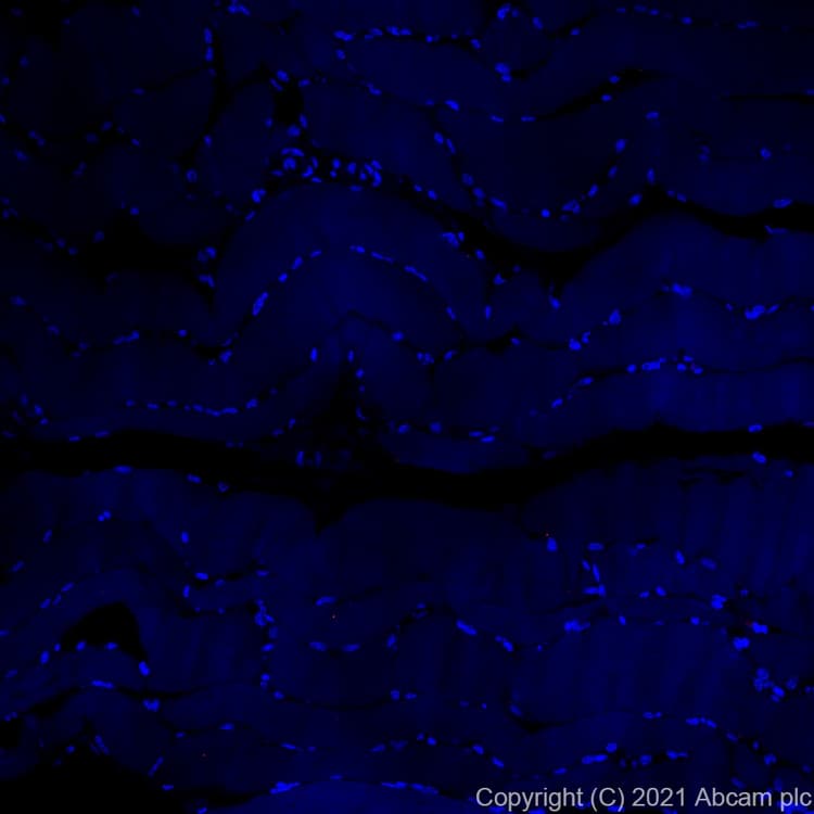 Alexa Fluor® 555 Anti-CD68 antibody [KP1](AB279323)