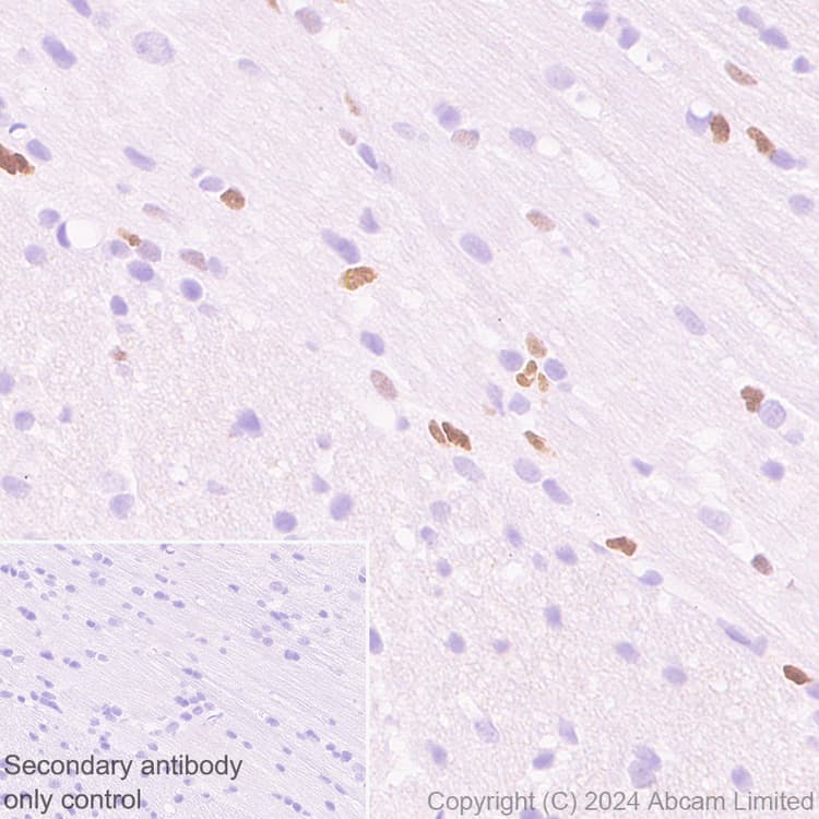 Anti-MASH1/Achaete-scute homolog 1 antibody [EPR19840](AB211327)