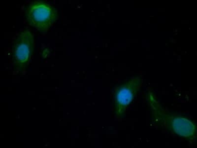 Anti-PI3 Kinase p110 beta antibody(ab232997)