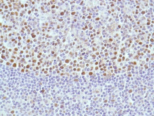 Anti-MSH2 antibody [SP46](AB231437)