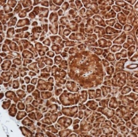 Anti-Smad4 antibody [SP306] - C-terminal, prediluted(AB228205)