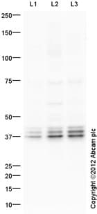 Anti-Aurora B antibody(AB2254)