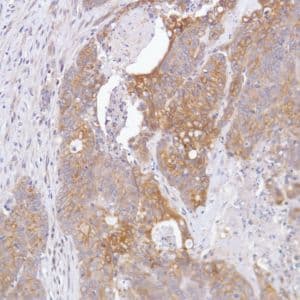 Anti-FGFR2 antibody [SP273] - BSA and Azide free(AB272012)