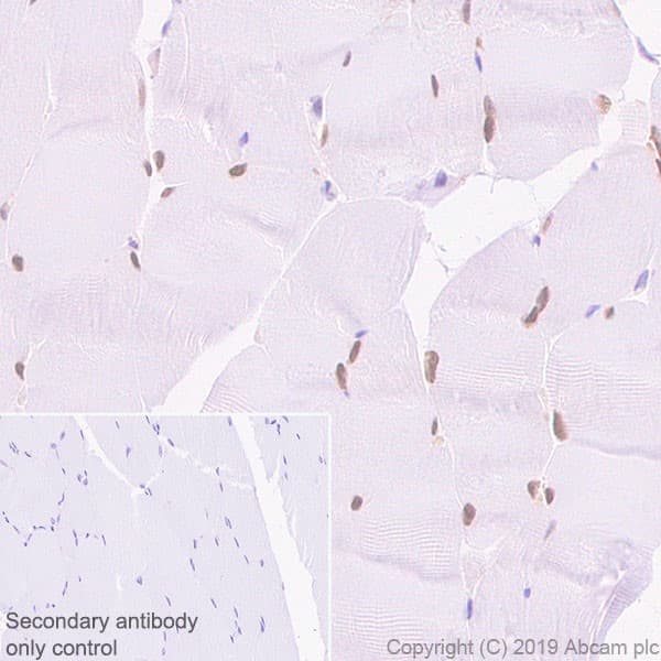 Six1 Antibody 1593 Ab243247  Immunohistochemistry Formalin Pfa Fixed Paraffin Embedded Sections Img113027