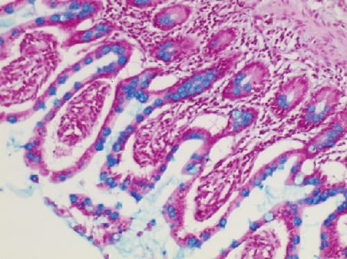 Alcian Blue Stain Kit (pH 2.5, Mucin Stain)(AB150662)