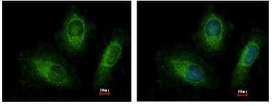 Rab20 Antibody Ab105043  Immunocytochemistry Immunofluorescence Img93948