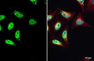 Anti-KMT3A / HYPB / HIF-1 antibody(AB184190)