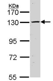 Casr Antibody Ab137408  Western Blot Img45838