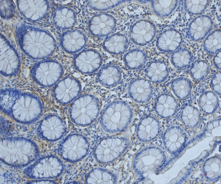 Anti-Periostin antibody(AB14041)