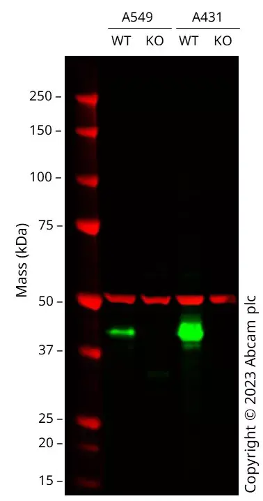 Anti-HLA A antibody [EP1395Y](AB52922)