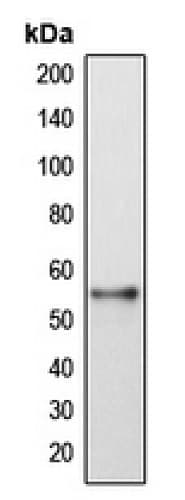 Anti-DFNA5/GSDME antibody(AB230482)