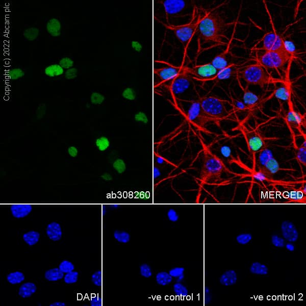 Arx Antibody Epr27481 32 Ab308260  Immunocytochemistry Immunofluorescence Img408872