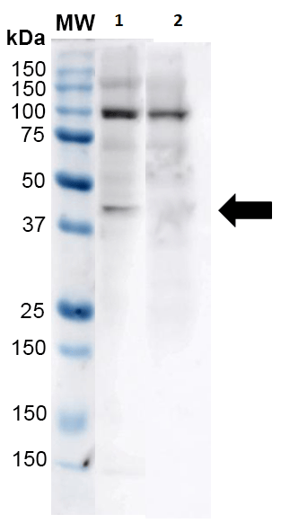 Anti-Kir4.1/KCNJ10 antibody(AB240876)