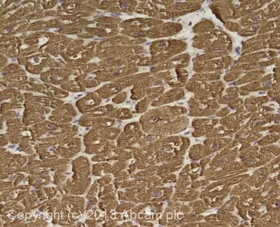 Anti-Cardiac Troponin I antibody [EP1106Y](AB52862)