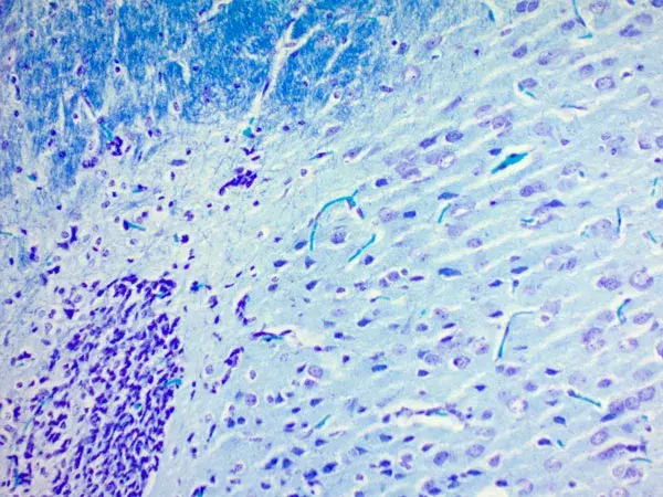 Luxol Fast Blue Stain Kit (Myelin Stain)(AB150675)