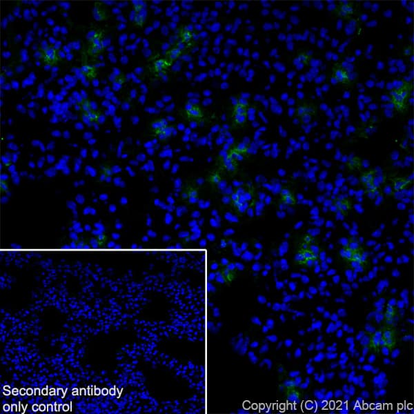 Anti-MMP9 antibody [RM1020](AB283575)