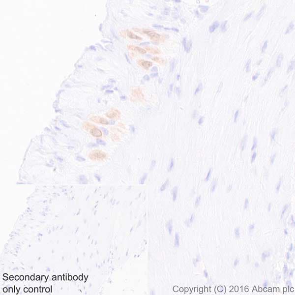 Anti-HuD + HuC antibody [EPR19098](AB184267)
