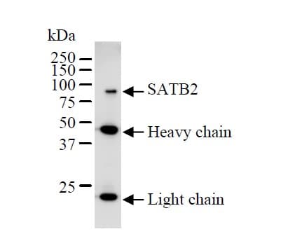 Anti-SATB1 + SATB2 antibody [SATBA4B10] - C-terminal(ab51502)