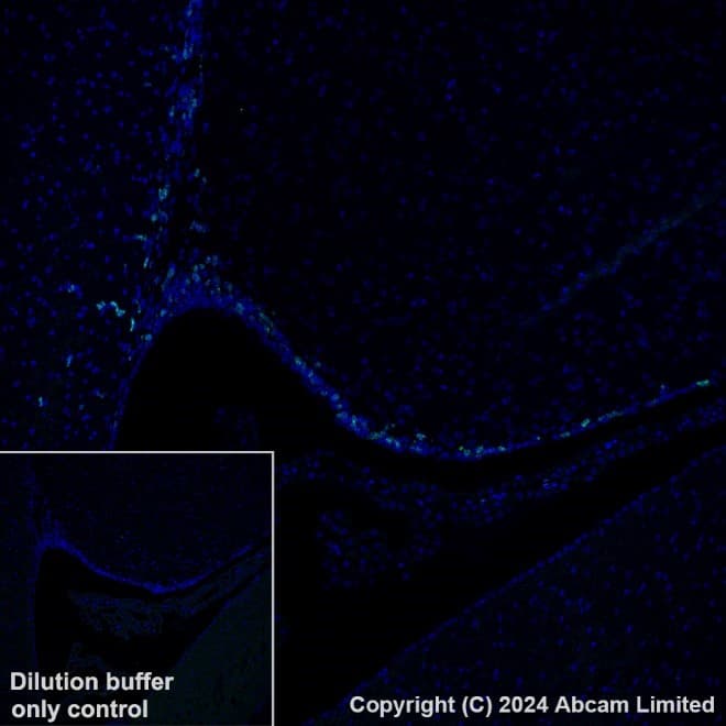 Anti-Ki67 antibody [B56](AB279653)