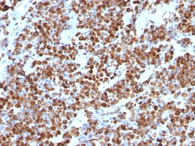 Vimentin Antibody Vm452 Bsa And Azide Free Ab212942  Immunohistochemistry Formalin Pfa Fixed Paraffin Embedded Sections Img114741