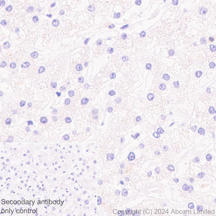 Anti-PADI2 / PAD2 antibody [EPR26940-85](ab322197)