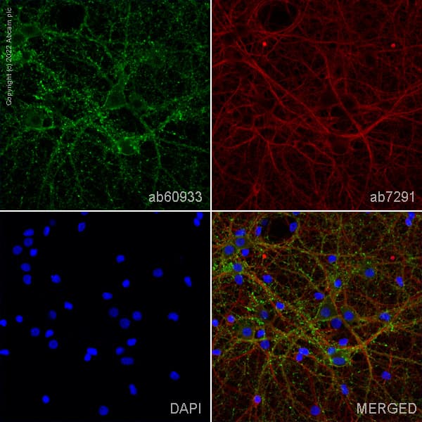Anti-Drebrin antibody(AB60933)