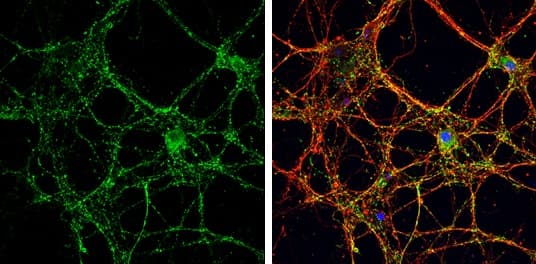 Anti-VGluT1 antibody(AB272913)