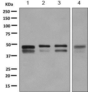 Anti-ZFYVE19 antibody [EPR9789](AB155085)