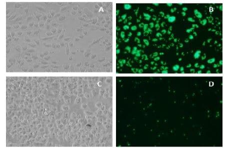 Phagocytosis Assay Kit (Green Zymosan)(AB234053)