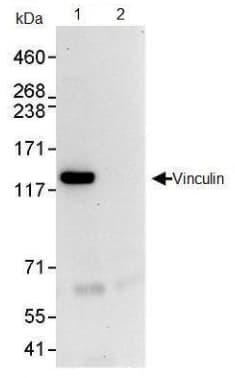 Anti-Vinculin antibody(AB91459)