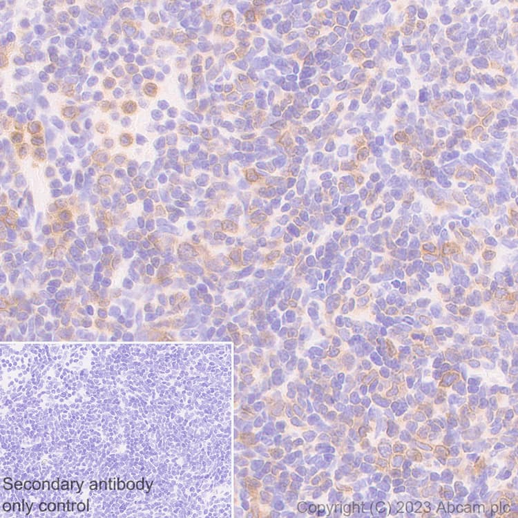Cd96 Antibody Epr26489 23 Bsa And Azide Free Ab315219  Immunohistochemistry Formalin Pfa Fixed Paraffin Embedded Sections Img424257