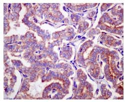 Anti-Ribosomal protein S11/RPS11 antibody [EPR11487](AB175213)