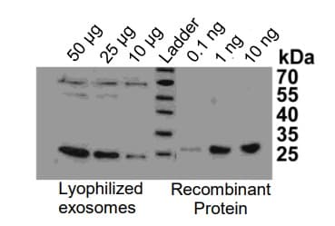 Overall Exosome Capture and Quantification ELISA Assay Kit(AB285284)