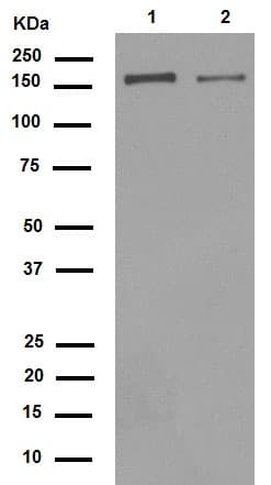 Anti-Integrin alpha 2 antibody [EPR5788](AB133557)