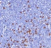 Ig Kappa Chain V Id Region 16 Antibody L1c1 Ab208164  Immunohistochemistry Formalin Pfa Fixed Paraffin Embedded Sections Img28351