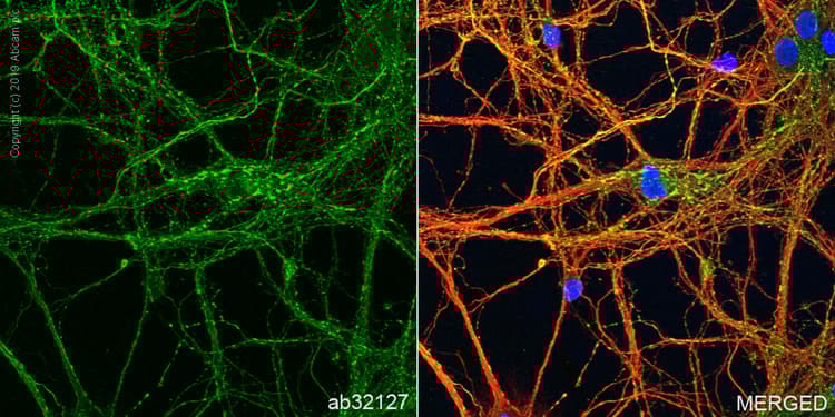 Anti-Synaptophysin antibody [YE269](ab32127)
